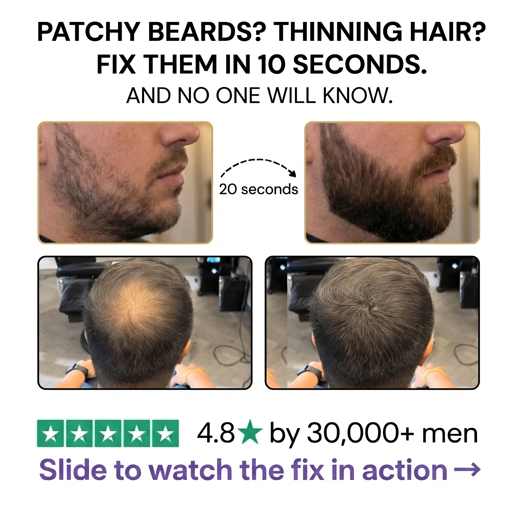 The Hair Density Filler™