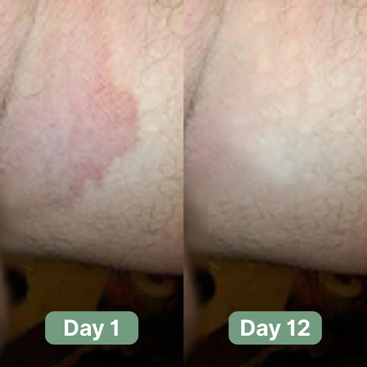 Skye Antifungal Soap
